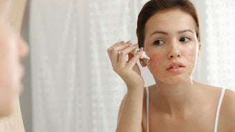 Teen girl with acne problem applying cream near mirror in bathroom