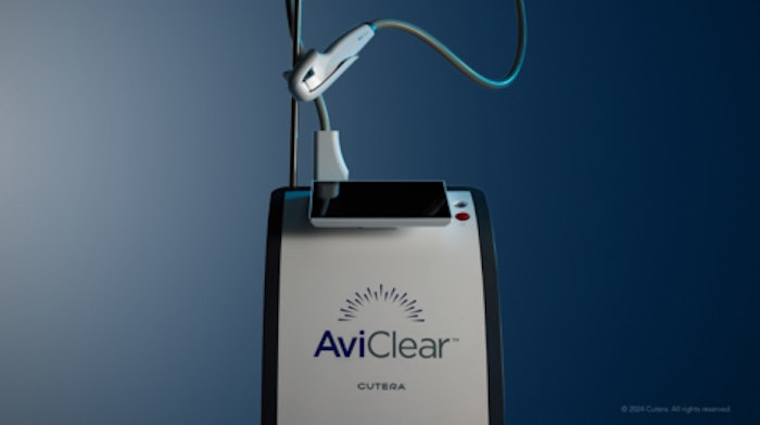 Cutera AviClear 1,726 nm Acne Laser International Release