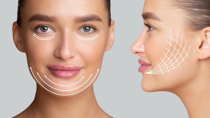 99% of readers want to learn about advances in minimally or non-invasive facelift procedures! Here are five new innovative approaches to minimally/non-invasive facelifts!