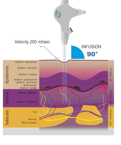 Skin Science Solutions MesoJet