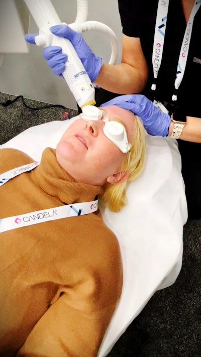 Aerolase Learning Lab: Neo Elite Treatment