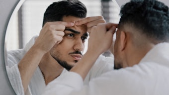 85% of readers are interested in non-hormonal acne treatments! Here are six non-hormonal acne treatment options for patients of all genders.