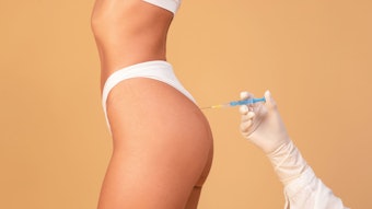 Futuristic fat transfer technologies promise to revolutionize this natural filler option.