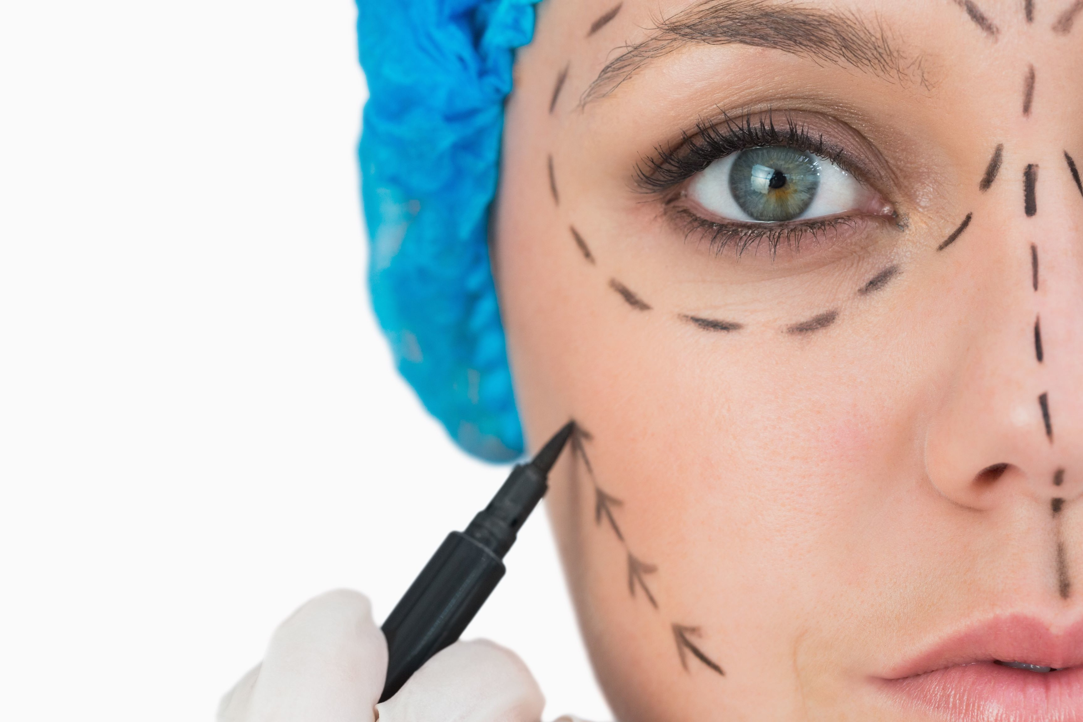 Plastic surgeon marking woman&apos;s face