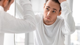Young man with hair loss problem looking in mirror at home
