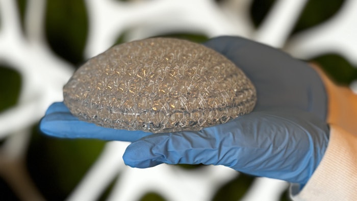 3D Printed Breast implant consisting of 200cc in volume of CollPlant’s rhCollagen-based bioinks produced on a Stratasys’ Origin® printer