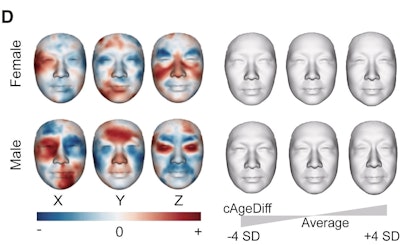 ThermoFace aging clock: Projections of ThermoFace PLSR cAgeDiff on a 3D facial image (left: color scale in arbitrary units). Red and blue denote, respectively, higher and lower values along x, y, and z axes (left). Synthesized female and male average profiles between −4 and +4 SD of loading values of PLS component 1 and 2 (right).