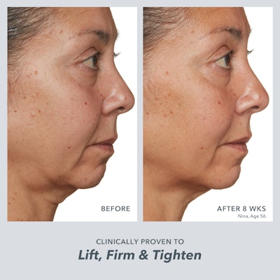 Among the brands leveraging exosomes are Beekman 1802, which features the Milk RX Advanced Better Aging Cream with two goat milk protein exosomes “that penetrate deeper into skin layers to fortify the skin barrier and promote skin longevity,” per the brand.