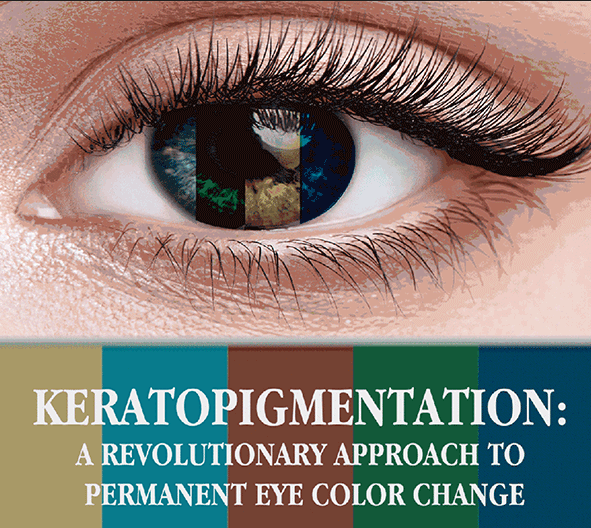 Close up image of eye with vertical lines showing different eye colors.