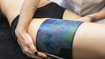 Cellulite Analysis