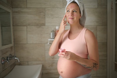 “The American College of Obstetricians and Gynecologists finds that acne affects about 40% of women during pregnancy,” says Beto Pino, Vice President of Product Innovation & Technical Marketing, Vantage.
