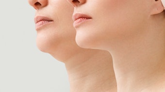 Adobe Stock 523647483