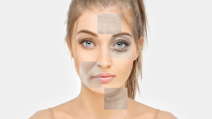 Signs of skin aging in young woman, signs of premature aging, Wrinkles and fine lines, Sagging skin, eyelid area