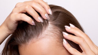 Elevai Labs Inc. launches S-Series Root Renewal System combining exosome and mitochondrial technology to target scalp and hair health at the cellular level.