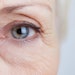As GLP-1 is increasingly used for weight loss in 2025, fillers will remain the mainstay of treating temporal volume loss.