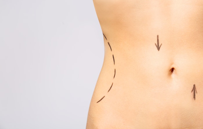Allergen Aesthetics foresees an uptick in aesthetics demand resulting from the rapid fat loss caused by GLP-1 use–specifically treatments that retain a natural look.