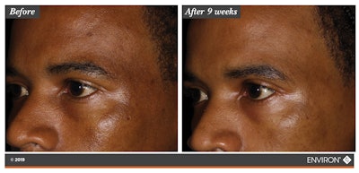 Focus Care Radiance+ 1