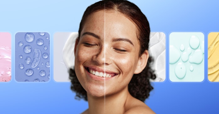 SkinGPT can visually generate and predict what effects certain external factors, like UV exposure, active ingredients or skin care products, will have on a consumer's skin over time.