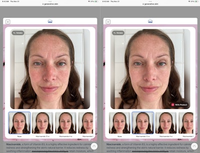 Example of GenerativeSkin forecasting the potential results of using niacinamide in a daily skin care routine.