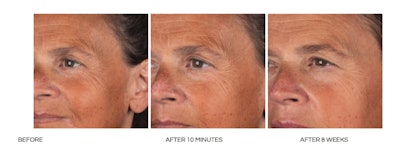 Medik8's newest launch, Liquid Peptides Advanced MP serum, reportedly delivers filler-like wrinkle relaxation, among other benefits.