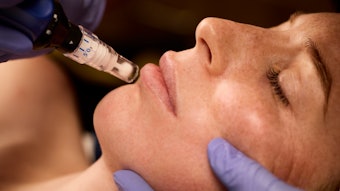 Crown Aesthetics has unveiled a new direct-to-consumer campaign, titled 'Feel Seen,' a compelling film series that highlights personal stories from individuals who have used the SkinPen.