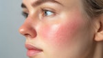 Neurotoxins, long recognized for their ability to smooth dynamic wrinkles, are now emerging as a groundbreaking treatment for inflammatory skin conditions.