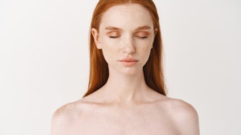 Allergan noticed patients and providers were often using different terminology in describing skin quality, creating a divide in providing effective care. This led to development of the Skin Quality Index.