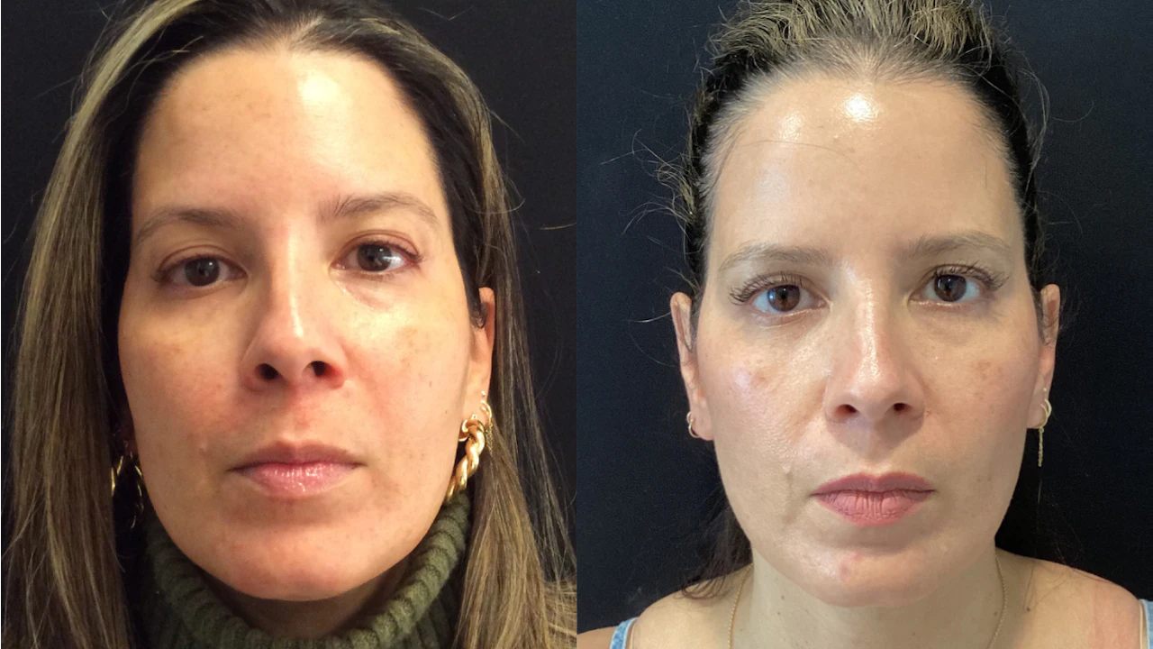 how long for compounded semaglutide to work Semaglutide weight loss dosage chart how long for compounded semaglutide to work Semaglutide weight loss dosage chart
