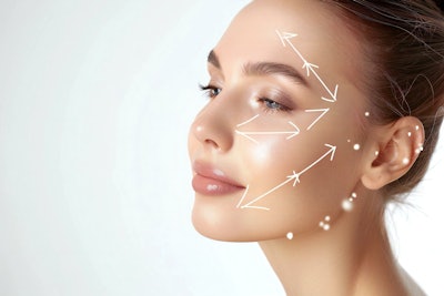 About 32% of AAFPRS patients seeking facelifts are now ages 35-55, suggesting that facelift patients are getting younger as they seek steps to prevent aging and preserve their youth before it occurs, and also as an increasing number of patients experience the “Ozempic effect.”
