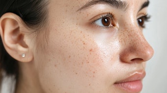 The dual-gas approach was used for argon's its antibacterial properties and safety profile, helping cleanse the skin and minimize bacterial load, while nitrogen is well-studied for promoting cell turnover and skin renewal,