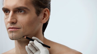 The July/August issue highlights the immense wave of preventive aesthetics and men’s motivation for facial rejuvenation, but also how to approach men’s procedures in plastic surgery, as their anatomy differs widely from women.