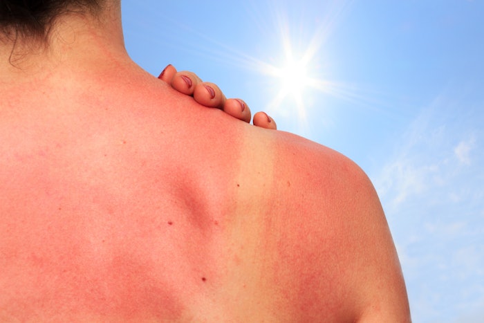 Designed to improve sun protection, YouV helps prevent skin damage by making application more accurate and visible.