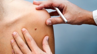 As skin organoids closely mimic real human skin, initially used for drug screening, they are now applied to study inflammatory conditions like psoriasis and melasma, as well as rare genetic diseases—revolutionizing personalization.