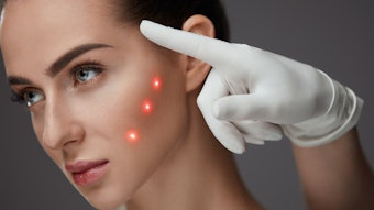 Register for Cutera's upcoming webinar, 'Transform Routine Treatments into High-Performance Results with 1064 nm,' taking place on Oct. 27.