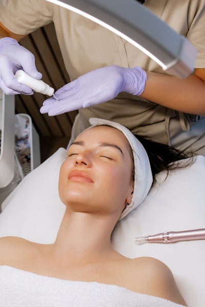 Microneedling creates microchannels that boost ingredient absorption—unlocking the full potential of serums when paired with the right actives.