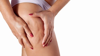 Despite countless treatments and products, most women say cellulite solutions fall short—revealing a deeper need for understanding, not just fixes.