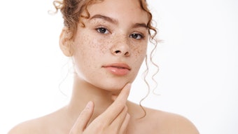 Extremozymes protect skin from environmental stressors like UV, heat and pollution