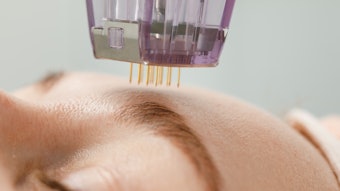 With at-home microneedling on the rise, education on safe product choices is key to preventing irritation and ensuring effective results.