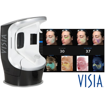 Canfield Scientific’s VISIA® Facial Skin Analysis