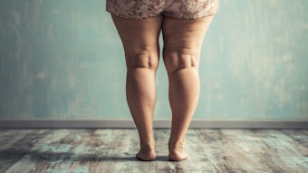 Most lipedema diagnoses come from non-surgeons, often years after symptoms begin—highlighting the urgent need for earlier recognition by aesthetic professionals.