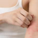Having so many people afflicted by sensitive skin means a growing demand for gentle, more specialized products.