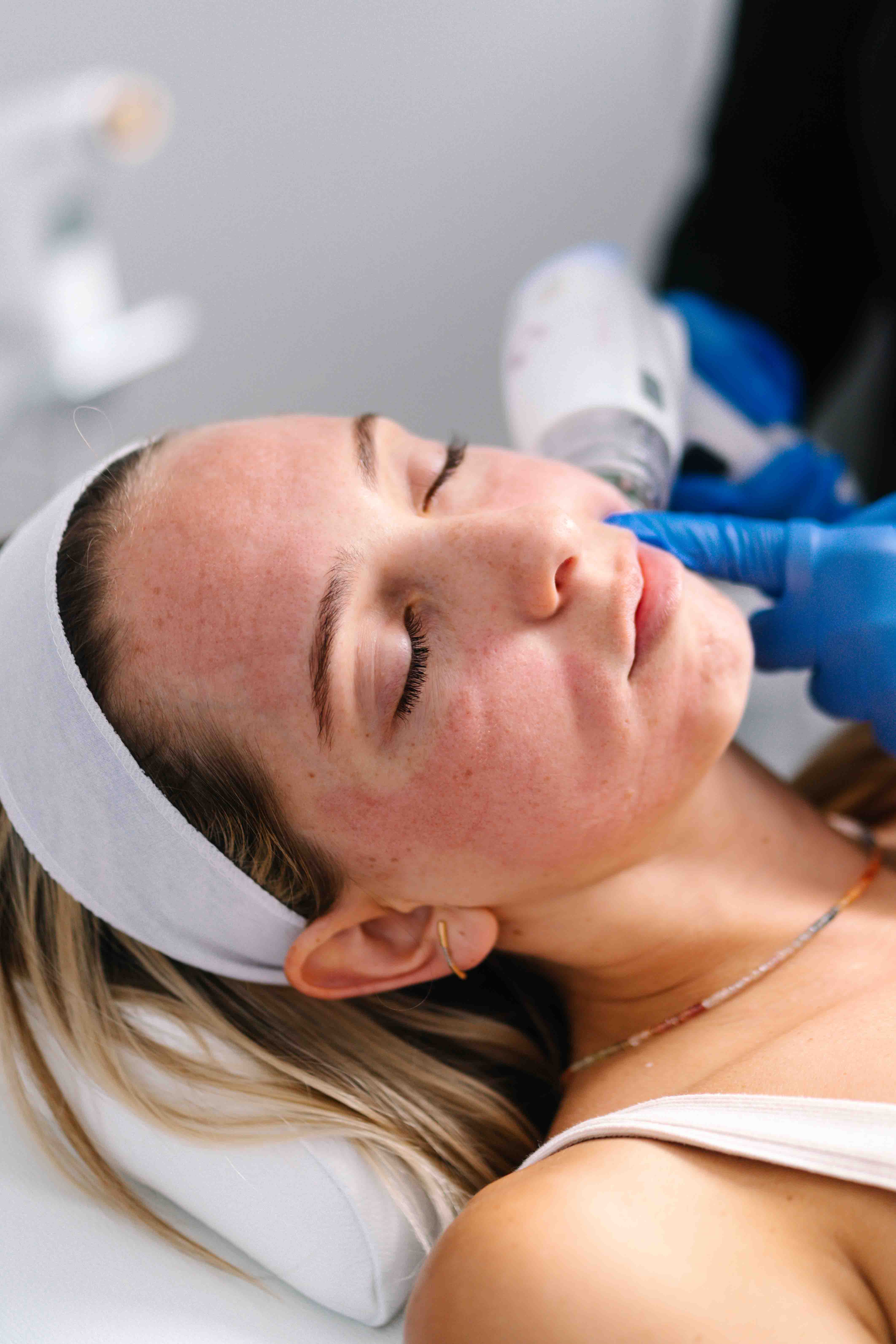 GLP-1 medications are driving rapid weight loss, creating new aesthetic needs. Matrix&trade; by Candela offers non-surgical solutions to restore facial volume and enhance texture, helping clinics meet patient demand.