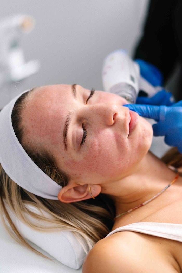 GLP-1 medications are driving rapid weight loss, creating new aesthetic needs. Matrix&trade; by Candela offers non-surgical solutions to restore facial volume and enhance texture, helping clinics meet patient demand.