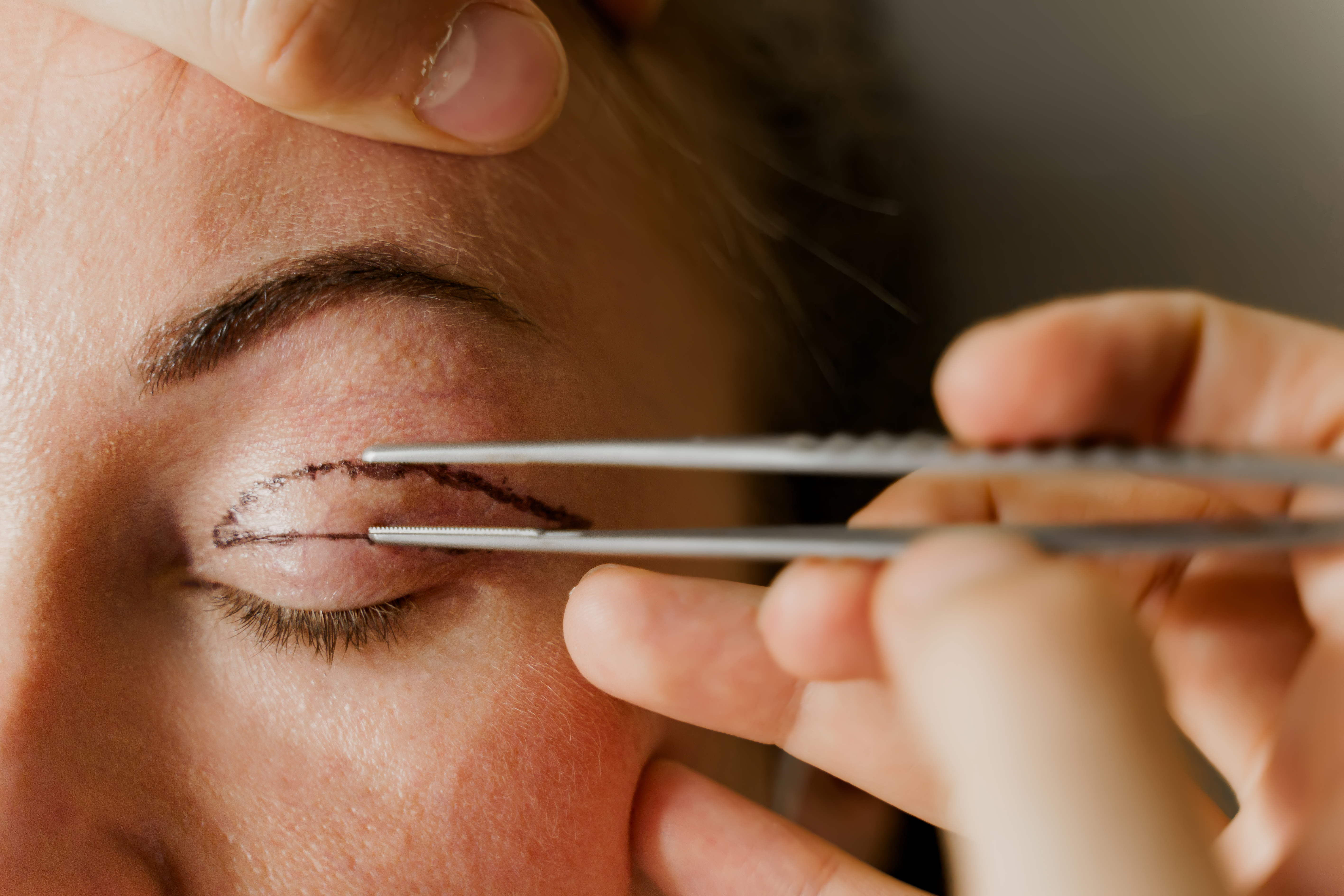 Facial Plastic Surgery I