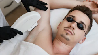 Laser Hair Removal I