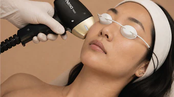Alma Laser Advertorial