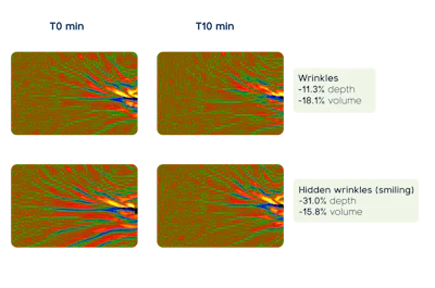 Before and after skin wrinkle analysis showing 11.3% depth and 18.1% volume reduction at 10 minutes, with thermal imaging comparison.