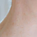 Close-up of fair skin with freckles and light spots near shoulder