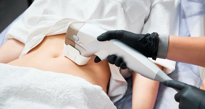 Aesthetic practitioner using handheld laser or IPL device on patient's leg during skin treatment procedure