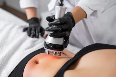 Aesthetic professional using radiofrequency device for skin treatment on patient's abdomen